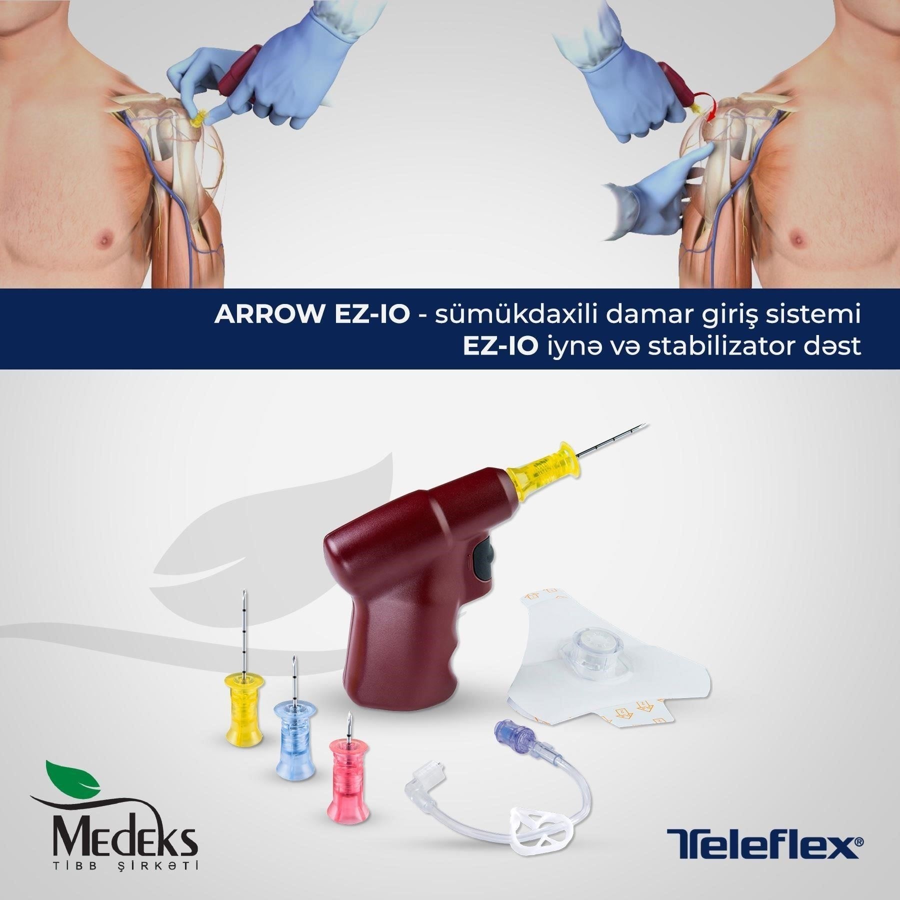 Медицинские состояния, требующие установки Arrow VUS